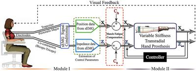 Design, Implementation, and Evaluation of a Variable Stiffness Transradial Hand Prosthesis